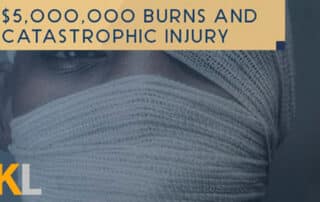 personal-injury-burns-by-kirakosian-law